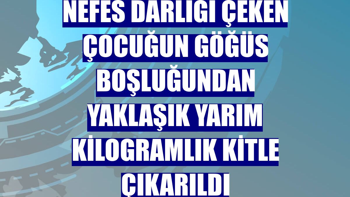 Nefes darlığı çeken çocuğun göğüs boşluğundan yaklaşık yarım kilogramlık kitle çıkarıldı