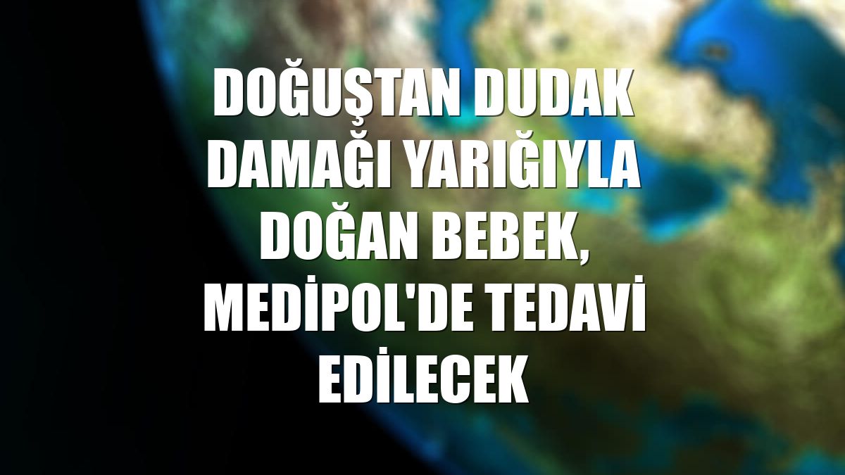 Doğuştan dudak damağı yarığıyla doğan bebek, Medipol'de tedavi edilecek